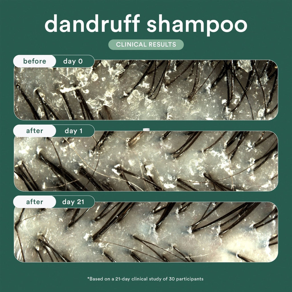 Dandruff Shampoo - reconnectbypb.com Shampoo Verb